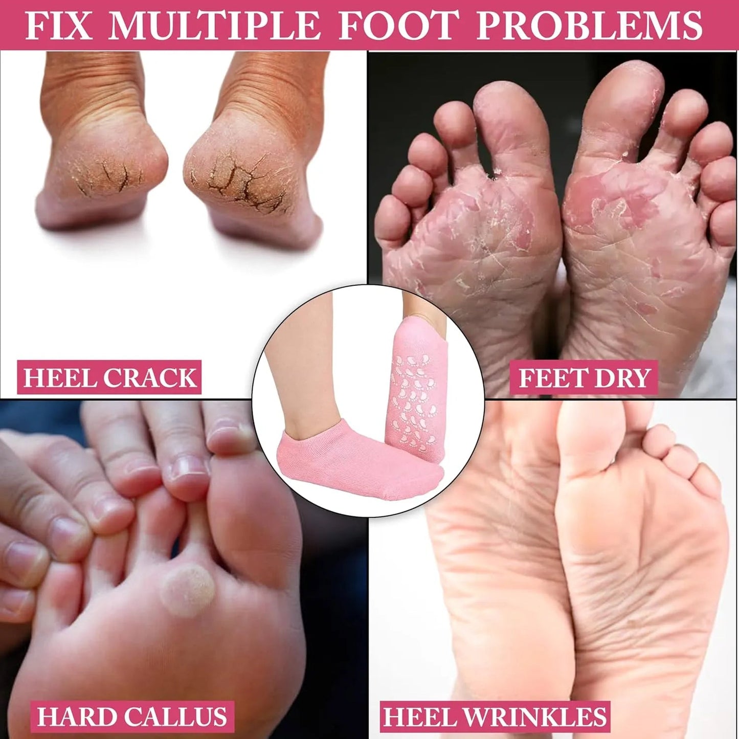 Silicone Moisturizing Gel Socks - Pair - My Store